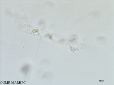 phyto/Scattered_Islands/iles_glorieuses/SIREME May 2016/Chaetoceros laciniosum (SIREME-Glorieuses2016-GG3-031116-chaetoceros3-3)(copy)_thumb.jpg